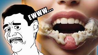 Chewing With Open Mouth Sound