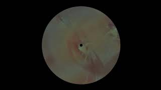 Fibonacci - Welcome Paranoia [TAMIRAS10]