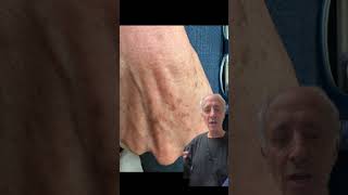 Aging of the Hands