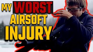 The True Cost of Ignoring Safety in Airsoft