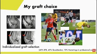 Innovations in the treatment of ACL Injuries - Prof Dr Christian Fink.