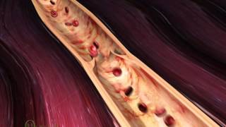 Medical animation demo