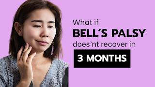 What if you don t recover from Bells palsy in 3 months?