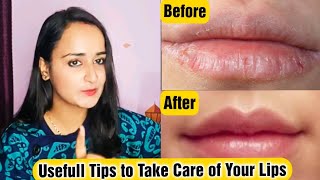 Lip Care | Healthy Usefull Tips to Take Care of Your Lips | Safar with_Rukmini Sharma #lipscare