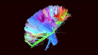 Muse - Save Me Live E-Werk 2012