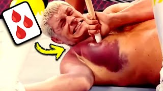 Real Doctor Reacts To Painful WWE Injuries