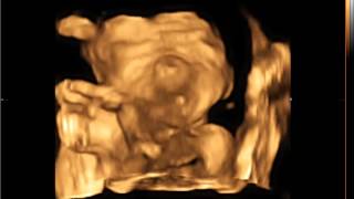 BABY CHRISTLE 14