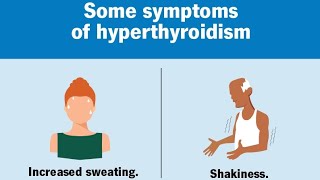 Hyperthyroidism: Symptoms, Causes & Treatment