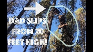Slipped from 20 feet HIGH!