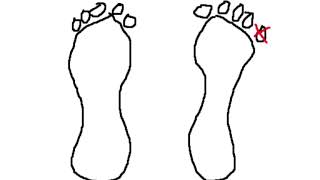 pinky toe (even flow parody)