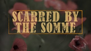 Scarred by the Somme