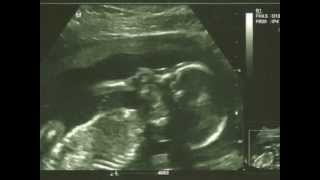 Heartbeat {27 weeks} #Mommy2K #blog #pregnancy