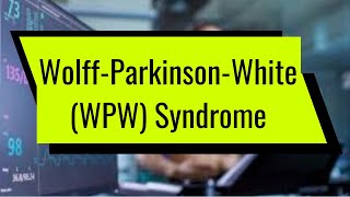Wolff-Parkinson-White (WPW) Syndrome
