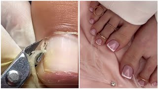 10 Most Satisfying Pedicure Transformation