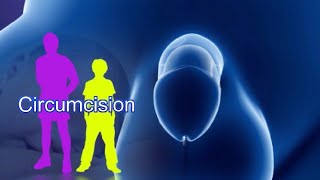 Circumcision: Anatomy, Indications, Procedure, Risks and Complications