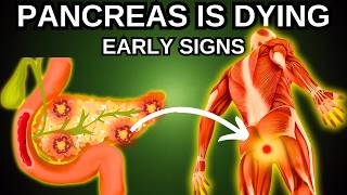 PANCREAS is DYING! Weird Signs of PANCREATIC DISEASE | Pancreatic Issues