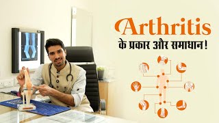 🦵 Understanding Arthritis and Its Types: Insights from Dr. Abhishek Rao at Numed Hospital 🏥