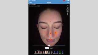 【3D VIEW】MC880 SKIN ANALYSIS/ANALYSER