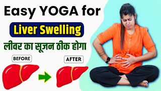 Best Yoga Poses for Liver Swelling