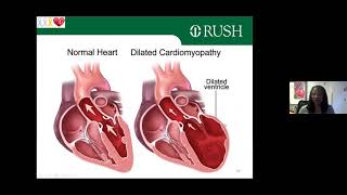 Long-Term Effects and Toxicities of Cancer Treatment on Cardiovascular Health