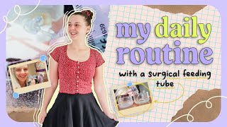 life with a feeding tube: my daily routine and tips!