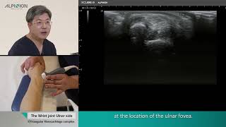 Musculoskeletal Ultrasound (Wrist and Hand) 04. Wrist: Ulnar side