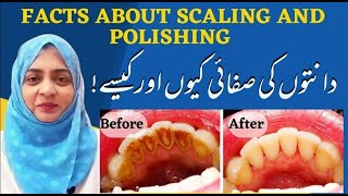 Facts about scaling and polishing