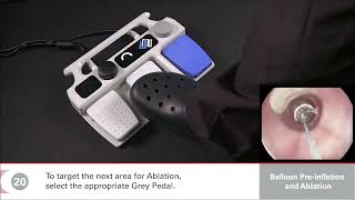 C2 CryoBalloon Ablation System [In-Service]