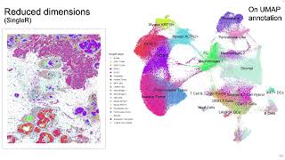 EuroBioC 2024 Demo: Orchestrating cellular resolution Spatial Transcriptomics with Bioconductor