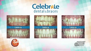 Celebrate Dental & Braces | SA Live | KSAT 12