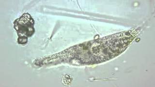 Uroleptus Preying on Heliozoan
