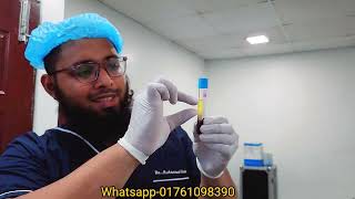 অবশেষে নিজে পিআরপি দিলাম।। PRP Therapy