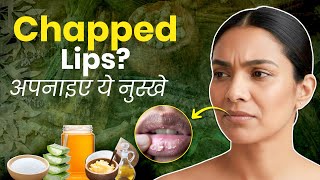 फटे होंठों के लिए 5 असरदार घरेलू नुस्खे | Chapped Lips Home Remedies I Aasan Nuskhe Behtar Zindagi