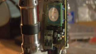 SPARKy Prosthetic Puts Spring Into Step