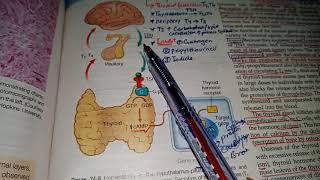 Thyroid adenoma