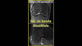 dictare live genunchi 12