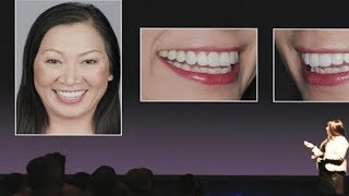 Chairside Live Episode 245: A Versatile Material for the Anterior: A BruxZir® Esthetic Case Report