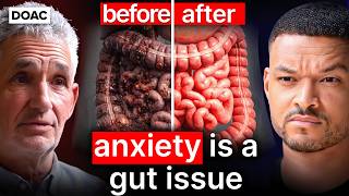 The Microbiome Doctor: Doctors Were Wrong! The 3 Foods You Should Eat For Perfect Gut Health!