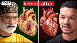 THIS Is #1 FASTEST Way To BURN Dangerous Fat