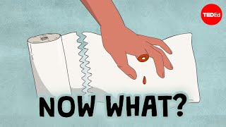 What should you do if you accidentally cut off your finger? - Jason Hoellwarth