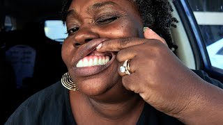 What I LOVE vs HATE About My Full Dental Implants