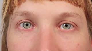 EYES