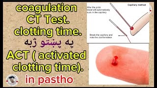 CT test/clotting time /ACT ( activated clotting time) coagulation capillary/slide method in pastho