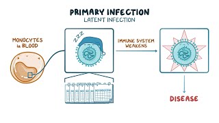 Understanding Cytomegalovirus (CMV) Infection After Transplant