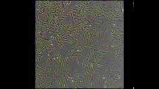 RCC4 cell tracking - Dr. Shintaro Maru (Hokkaido University)