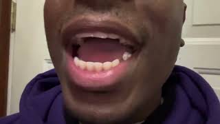 Asmr Eating Gum For Sleep