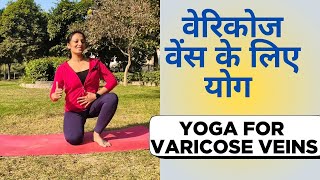 Yoga for Varicose Veins# नीली नसों की समस्या से राहत #varicoseveins