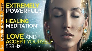 Extremely Powerful Guided Meditation.  Experience Deep Love And Acceptance For Yourself.  Healing.