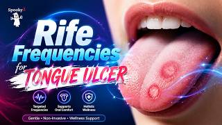 Rife Frequencies for Tongue Ulcer Support | Oral Health & Mouth Healing Audio | Spooky2  Healing
